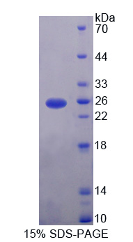 含CUB域蛋白1(CDCP1)重组蛋白