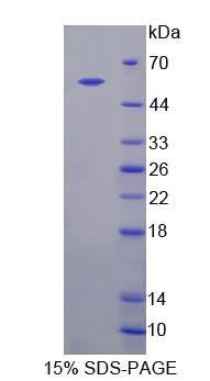 含IQ基元GTP酶激活蛋白1(IQGAP1)重组蛋白