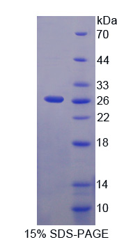 含Mab21域蛋白1(MB21D1)重组蛋白