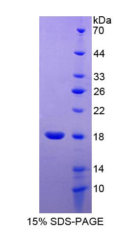 含RCC1和BTB域蛋白2(RCBTB2)重组蛋白