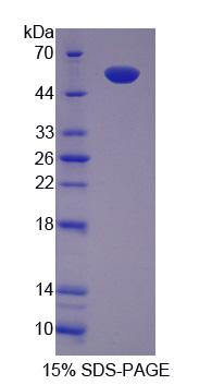 含TCP1伴侣蛋白亚基2(CCT2)重组蛋白