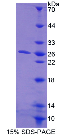 含胶原三螺旋重复蛋白1(CTHRC1)重组蛋白