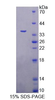 含三核苷酸重复序列蛋白6A(TNRC6A)重组蛋白