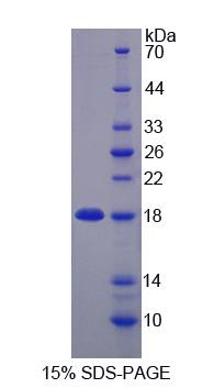 含锌飘带域蛋白1(ZNRD1)重组蛋白