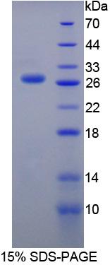 含硬化蛋白域蛋白1(SOSTDC1)重组蛋白