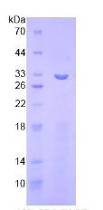 含整合素αFG GAP重复蛋白1(ITFG1)重组蛋白