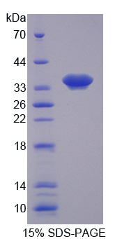 核膜含血影蛋白重复蛋白1(Nesp1)重组蛋白