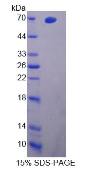 核受体亚家族1D组成员2(NR1D2)重组蛋白