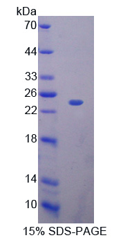 核糖核酸酶A11(RNASE11)重组蛋白