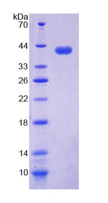 核小体装配蛋白1样1(NAP1L1)重组蛋白
