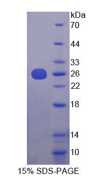 赫曼斯基普德拉克综合征蛋白4(HPS4)重组蛋白
