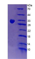 红细胞补体受体1(CR1)重组蛋白