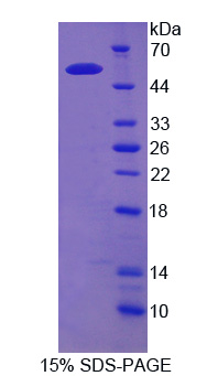红细胞膜蛋白带4.2(EPB42)重组蛋白