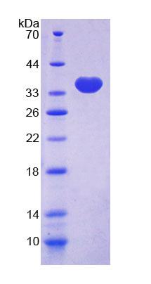 踝蛋白2(TLN2)重组蛋白