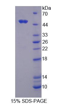 环指蛋白39(RNF39)重组蛋白