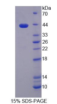 组蛋白脱乙酰基酶9(HDAC9)重组蛋白