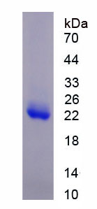 组蛋白脱乙酰基酶6(HDAC6)重组蛋白