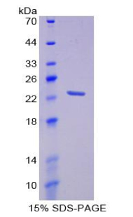 棕榈酰化膜蛋白6(MPP6)重组蛋白