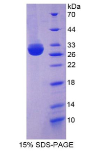 棕榈酰化膜蛋白5(MPP5)重组蛋白