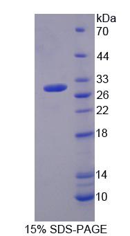 棕榈酰化膜蛋白2(MPP2)重组蛋白