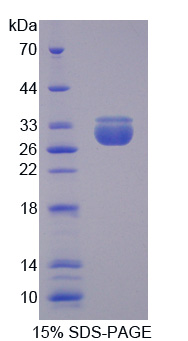 转运蛋白2(TNPO2)重组蛋白