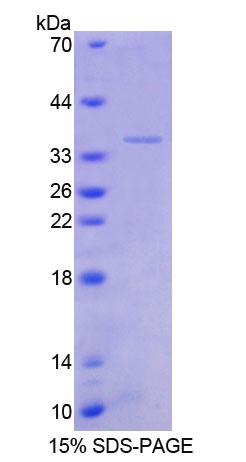 转化生长因子β刺激蛋白22(TSC22)重组蛋白