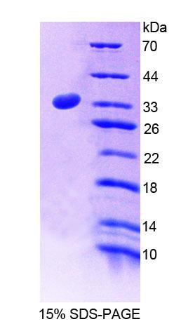 珠丝结构蛋白1(BFSP1)重组蛋白