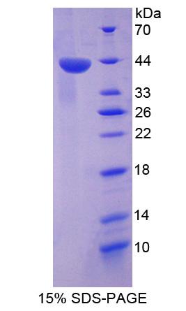 肿瘤蛋白p53(TP53)重组蛋白