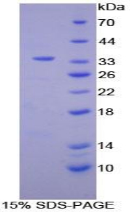 中性粒细胞特异性抗原1(NB1)重组蛋白