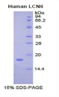 脂质运载蛋白6(LCN6)重组蛋白