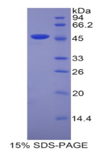 脂质运载蛋白4(LCN4)重组蛋白