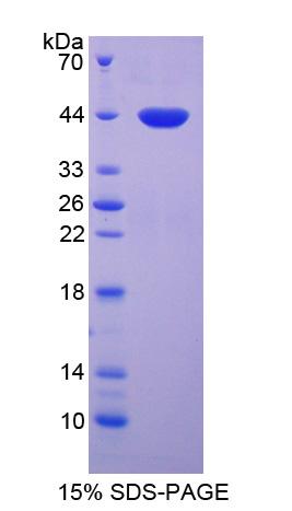 脂质运载蛋白12(LCN12)重组蛋白