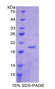 脂质运载蛋白1(LCN1)重组蛋白