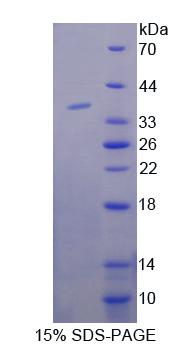 张力蛋白3(TNS3)重组蛋白