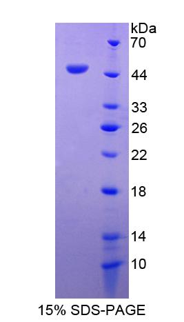 粘附调节分子1(ADRM1)重组蛋白