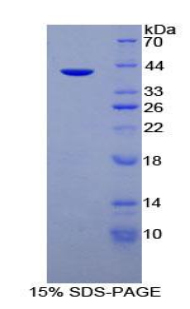 粘蛋白6(MUC6)重组蛋白