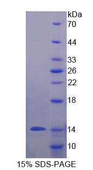 粘蛋白3B(MUC3B)重组蛋白