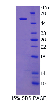 粘蛋白20(MUC20)重组蛋白