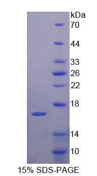 早期内体抗原1(EEA1)重组蛋白