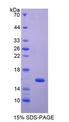 再生胰岛衍生蛋白4(REG4)重组蛋白