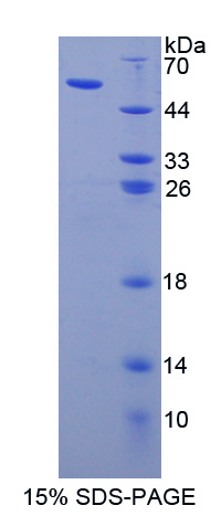 载脂蛋白L1(APOL1)重组蛋白