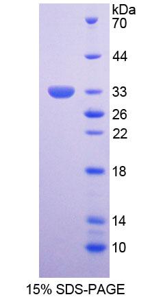 运动神经元生存蛋白2(SMN2)重组蛋白