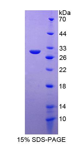 孕酮免疫调节结合因子1(PIBF1)重组蛋白