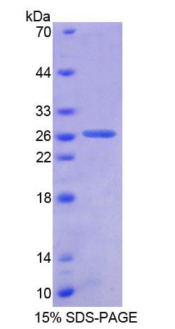 原始广泛存在蛋白1(AUP1)重组蛋白
