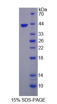 原肌球调节蛋白3(TMOD3)重组蛋白