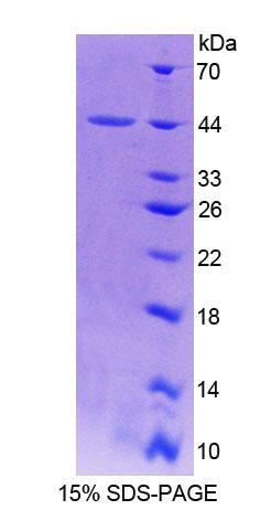 抑丝蛋白3(PFN3)重组蛋白