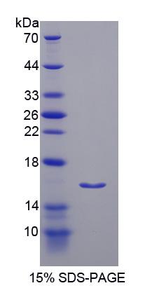 胰岛素受体底物3(IRS3)重组蛋白