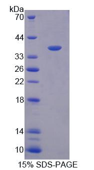 氧固醇结合蛋白样蛋白8(OSBPL8)重组蛋白