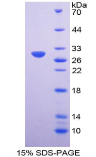 岩藻糖基转移酶3(FUT3)重组蛋白