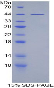 血小板因子4V1(PF4V1)重组蛋白